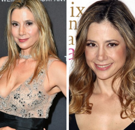 mira sorvino plastic surgery.